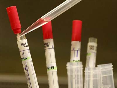 基因检测：理想丰满 现实骨感