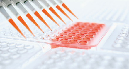 IVD价钱压力持续增大 经济型试剂更受医院青睐